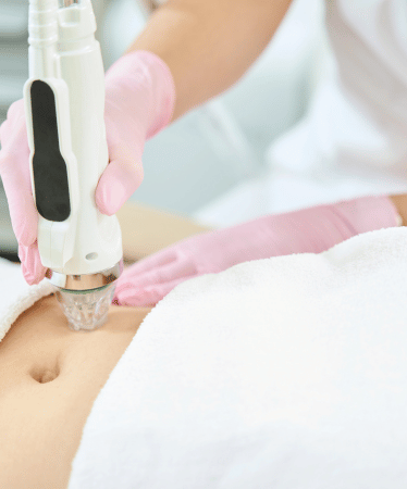 servicos-lipoaspiracaoalaser-xpert